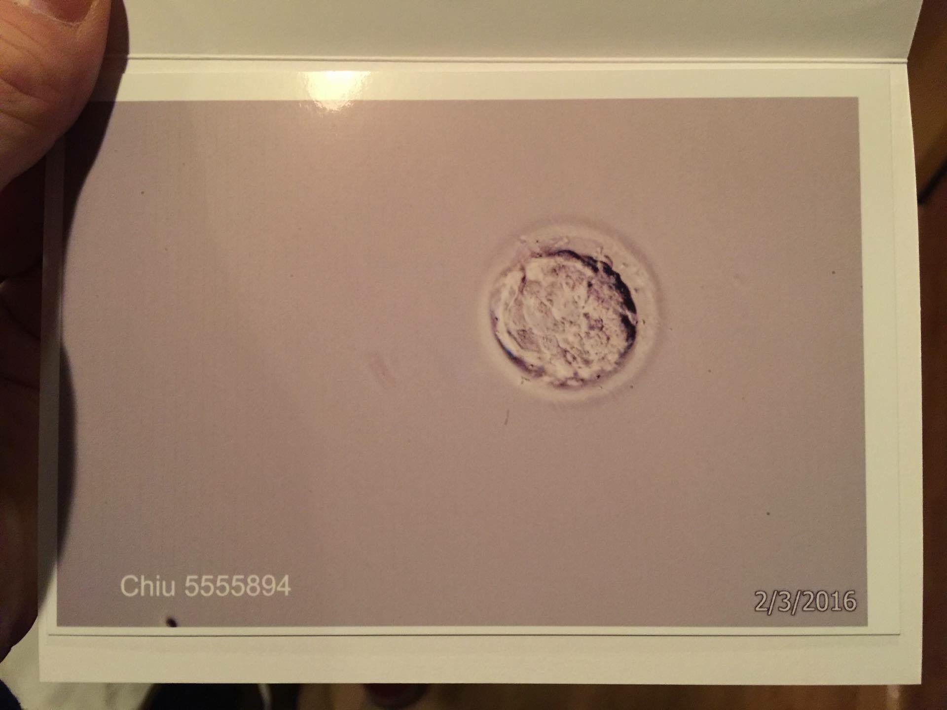 Embryo Picture
