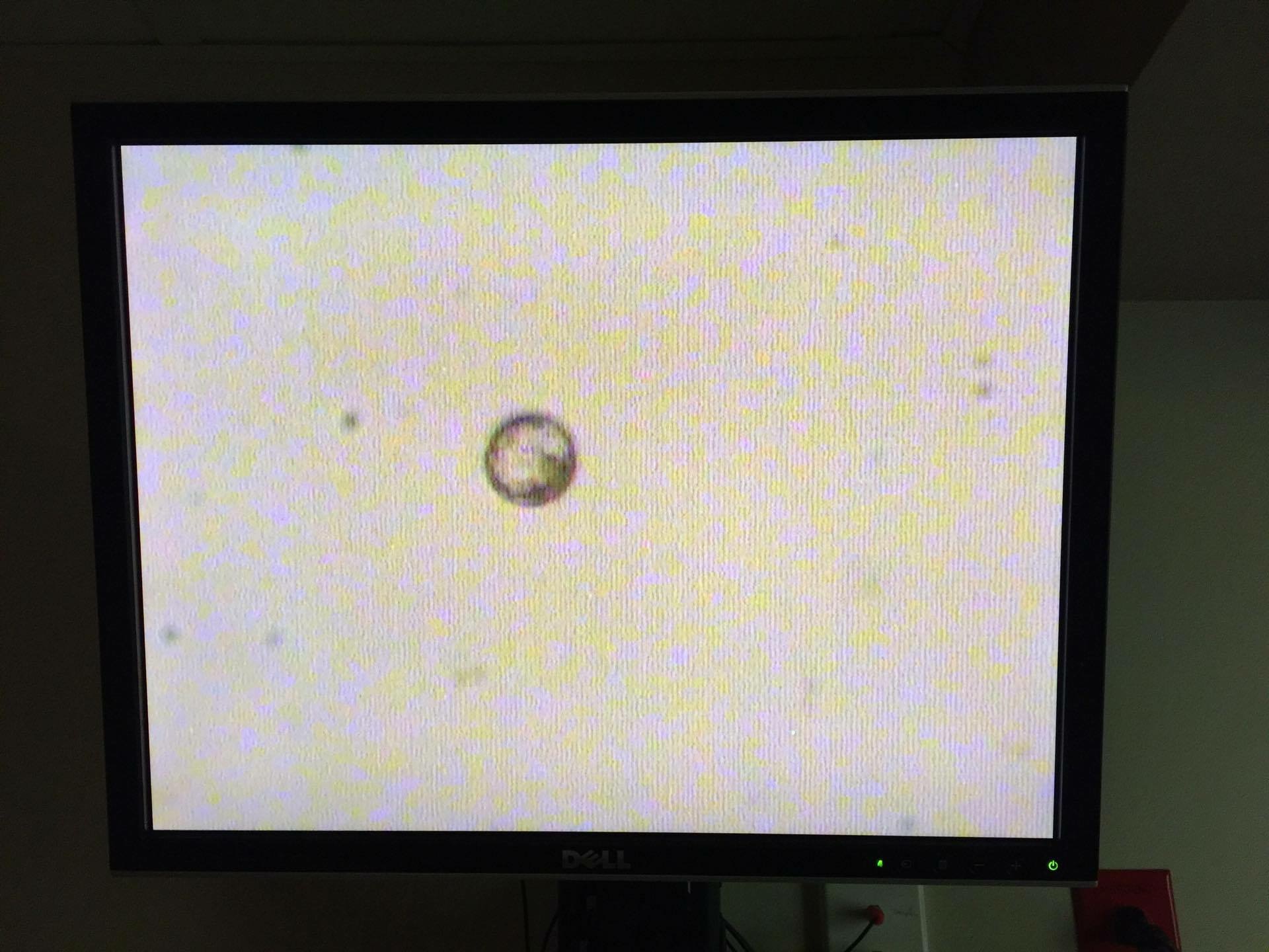 Embryo on the screen
